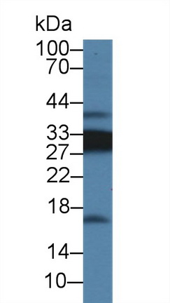 14457