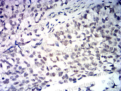 Валидация AntibodySystem RHF84504 (2699)