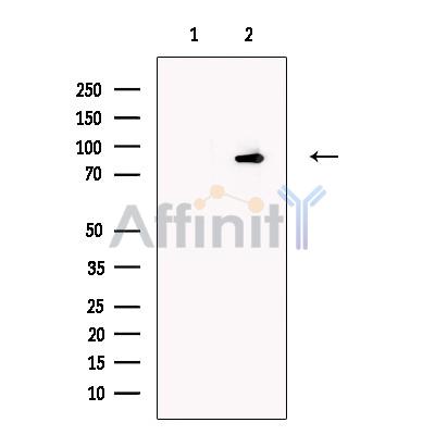 Валидация Affinity DF13612 - 9120