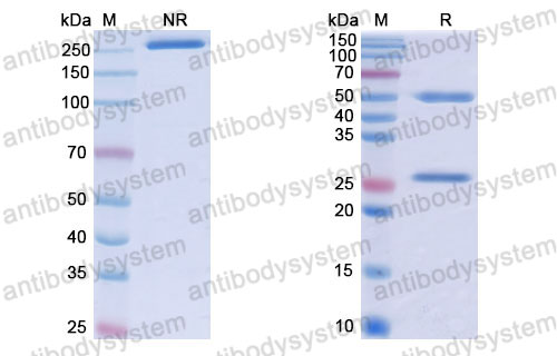 Валидация SDS-PAGE - AntibodySystem RHJ92805