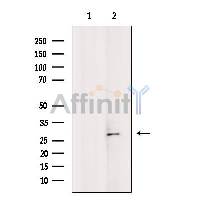 Валидация Affinity DF3198 - 14015