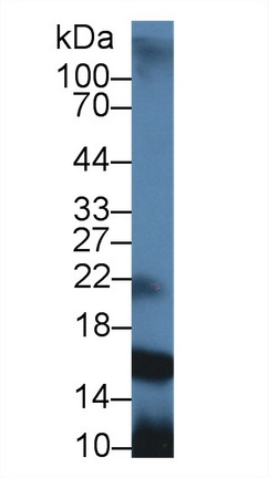 10125