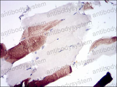 Валидация AntibodySystem RHK40101