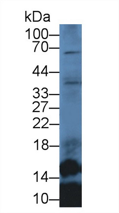 12923