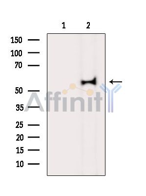 Валидация Affinity DF14378 - 10301
