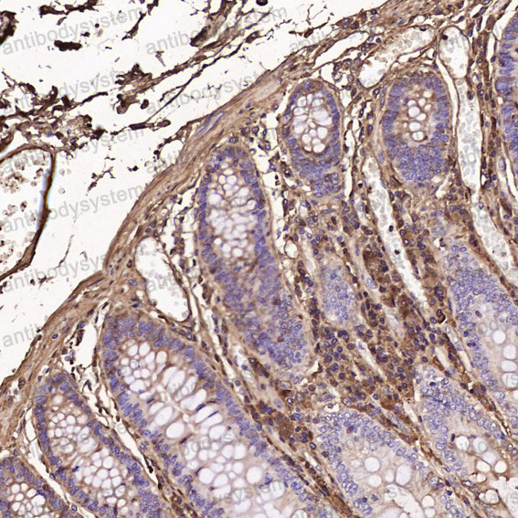 Валидация AntibodySystem RHJ92831 (3590)