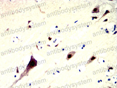 Валидация AntibodySystem RHN99402