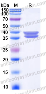 EHJ46901, SDS-PAGE
