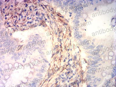 Валидация AntibodySystem RHH09402