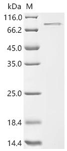 SDS-PAGE