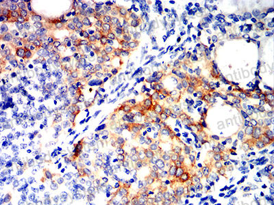 Валидация AntibodySystem RHB34206