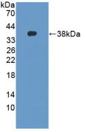 38809