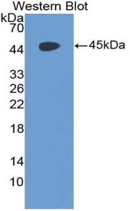 55575