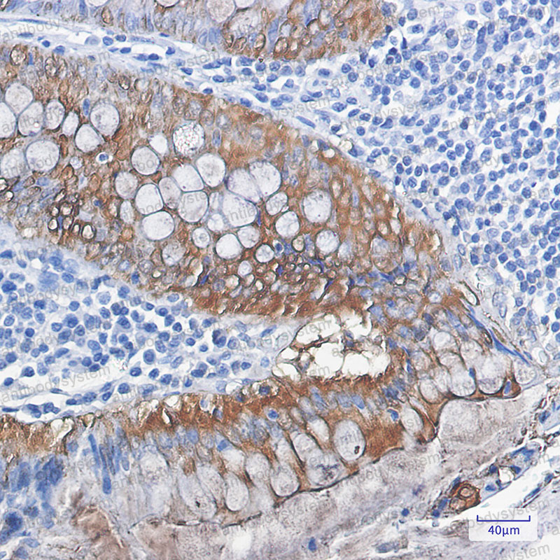 Валидация AntibodySystem RHD27107