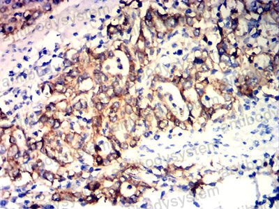 Валидация AntibodySystem RHD17407