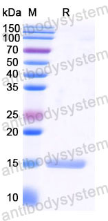 Валидация SDS-PAGE - AntibodySystem RHD99502