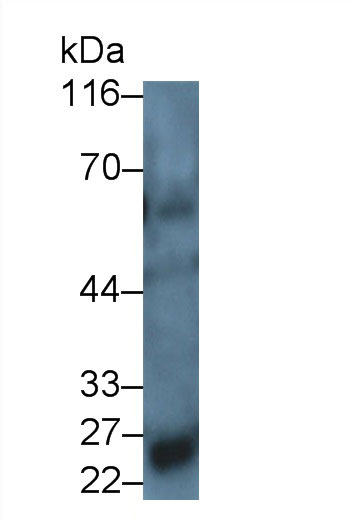 30825
