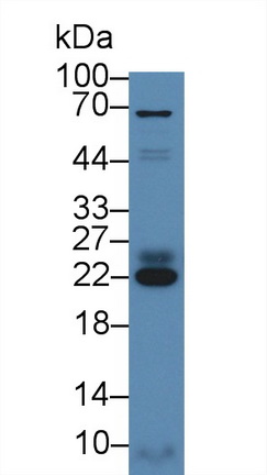 13956
