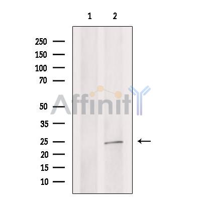 Валидация Affinity DF6562 - 18000