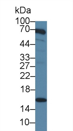 14177