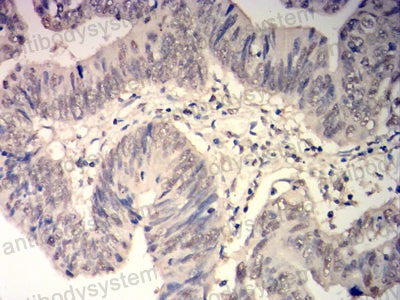 Валидация AntibodySystem RHC39303