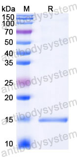 Валидация SDS-PAGE - AntibodySystem RVV29001
