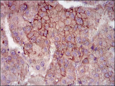 Валидация AntibodySystem RHG86803 (3102)