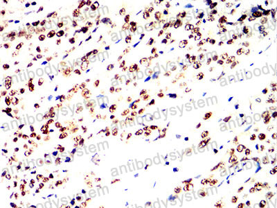 Валидация AntibodySystem RHD14102 (1347)