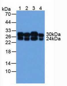 5592
