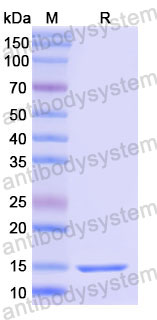 Валидация SDS-PAGE - AntibodySystem RMD30402