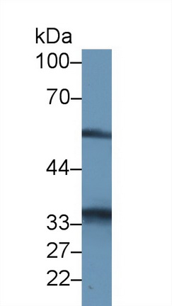 14509