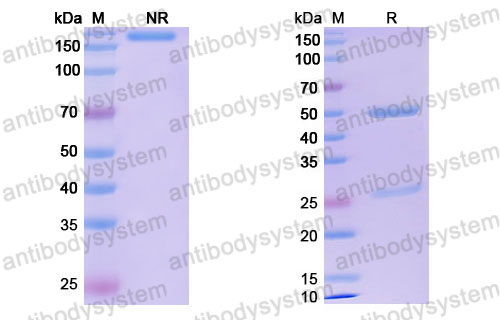 Валидация SDS-PAGE - AntibodySystem DHC65502