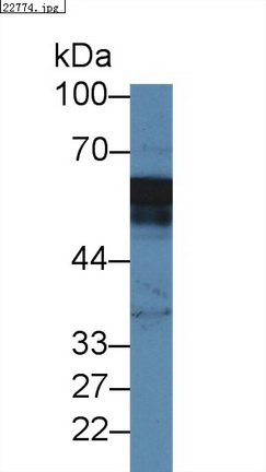 14386