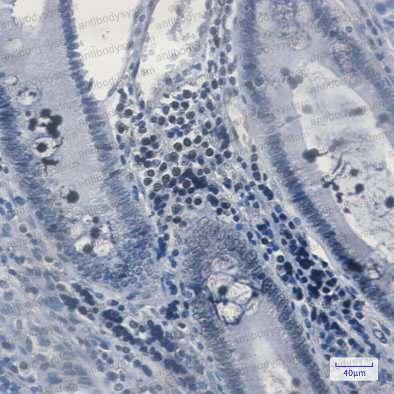 Валидация AntibodySystem RHD17902