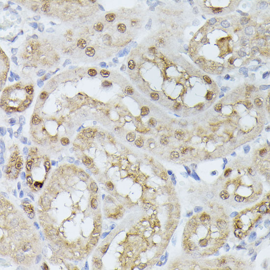 A15733, иммуногистохимия, парафиновые срезы почки крысы (10685)
