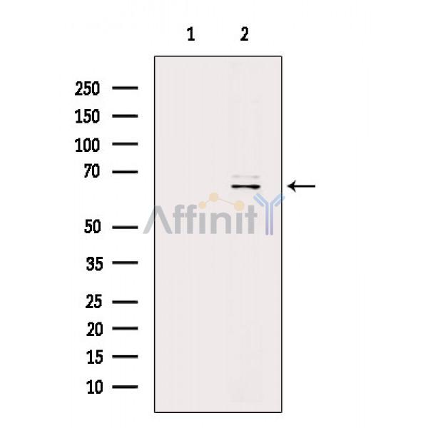 Валидация Affinity AF6370 - 3664