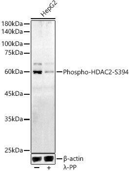 AP0201, вестерн-блоттинг, лизат клеток HepG2 (24642)