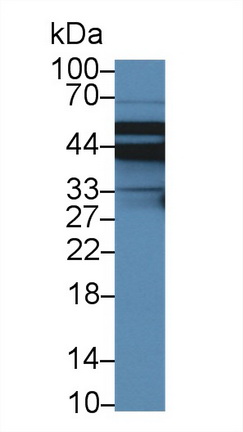 13964