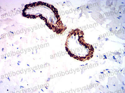 Валидация AntibodySystem RHD80703