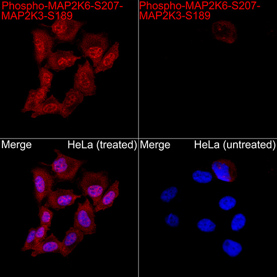 AP1512, иммунофлуоресценция, клетки HeLa (28467)
