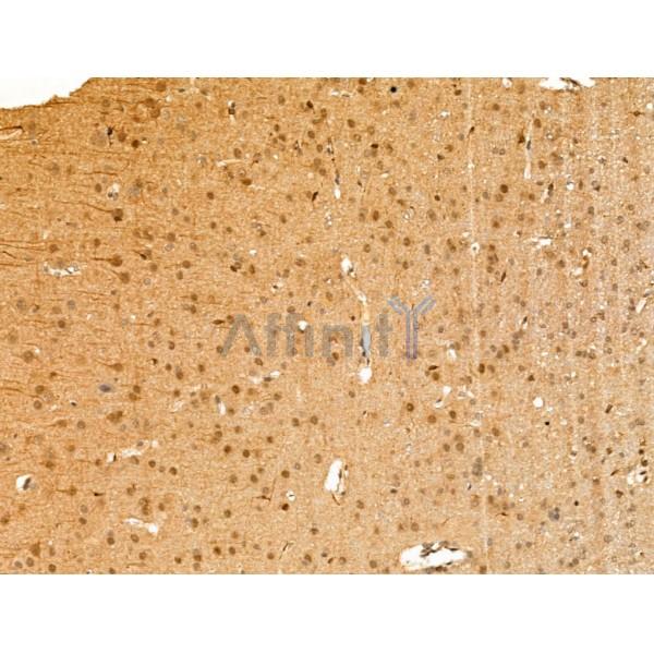 Валидация Affinity DF13396 - 8667
