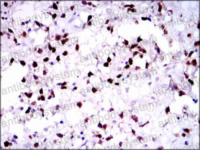 Валидация AntibodySystem RHF94702 (2744)