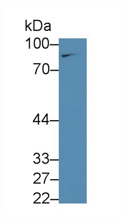 13962