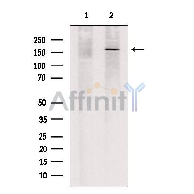 Валидация Affinity DF13335 - 8521