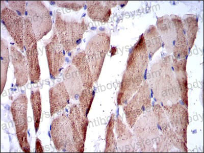 Валидация AntibodySystem RHE61803