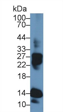 17693