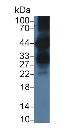 52685
