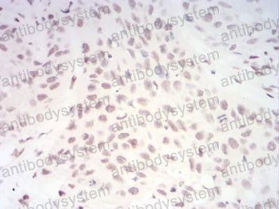Валидация AntibodySystem RHF75403