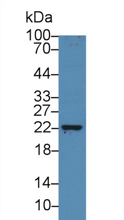 13958