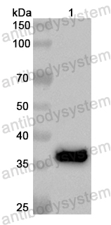 Валидация AntibodySystem PHB16601